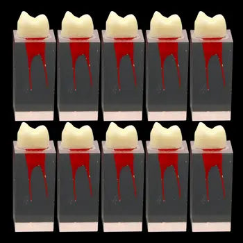 10vnt Dantų Endo Dantų Šaknų Kanalų Modelis Bendrosios Praktikos RCT Pulpos Ertmės Tyrimas-